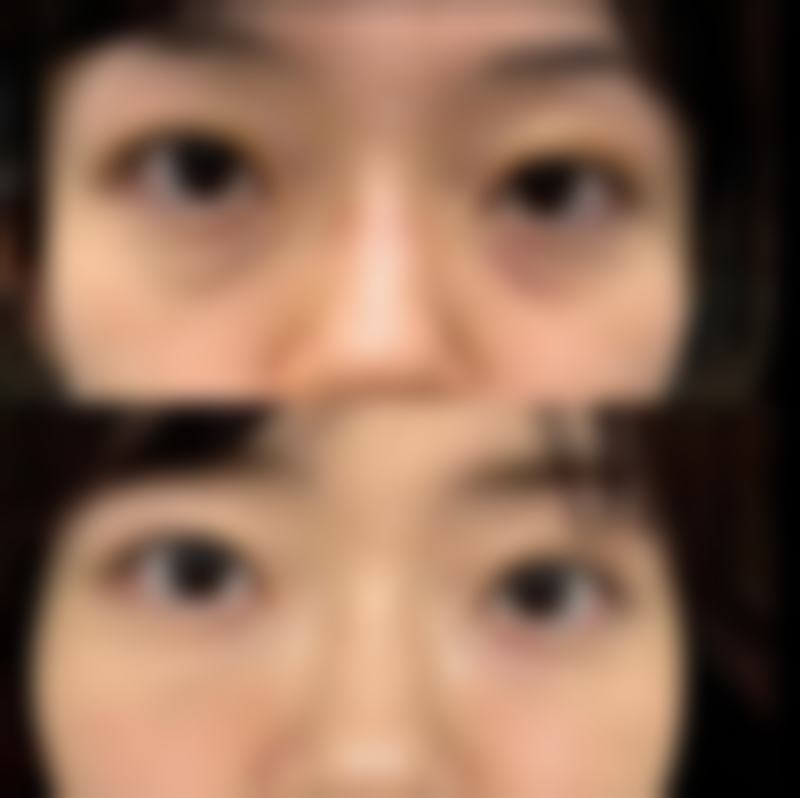 怀孕能打玻尿酸和瘦脸针吗？专业解析孕期医美风险，为你揭秘安全变美攻略及三大注意事项！ 