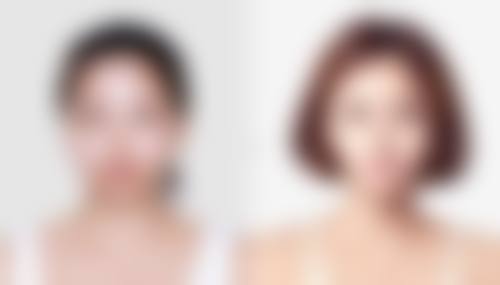 保妥适除皱针多少钱一支