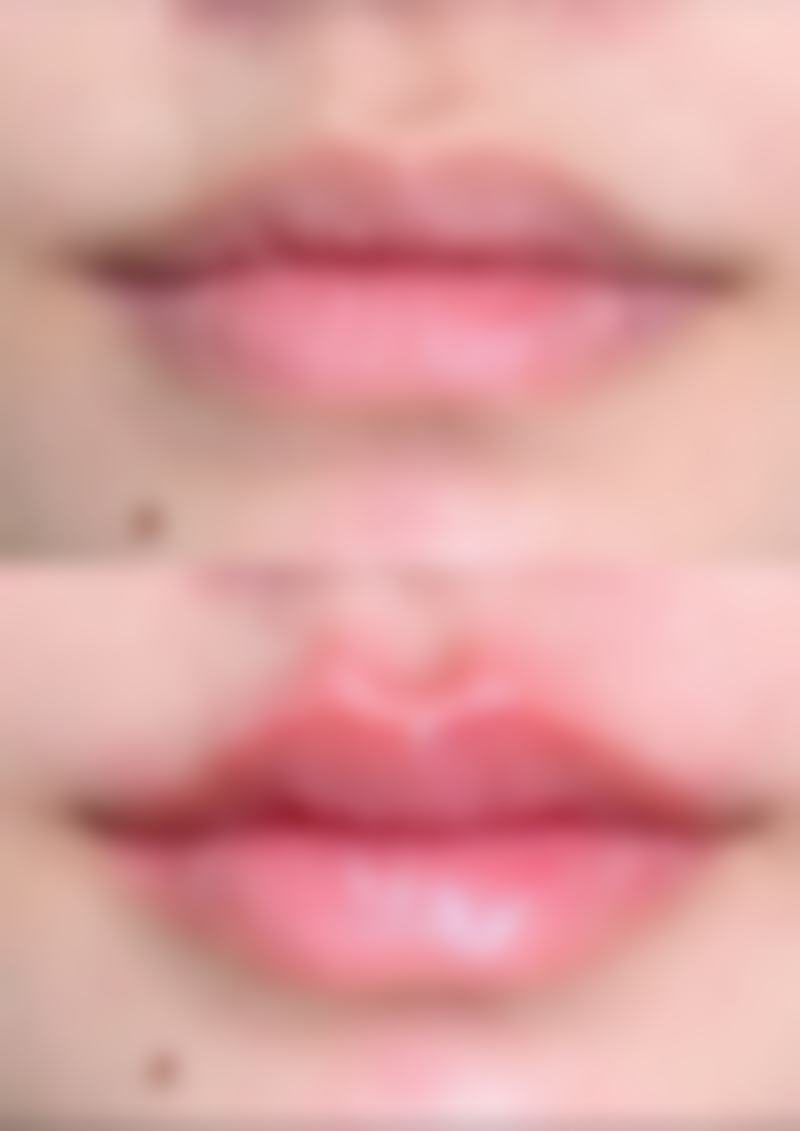 植发价格及适用人群