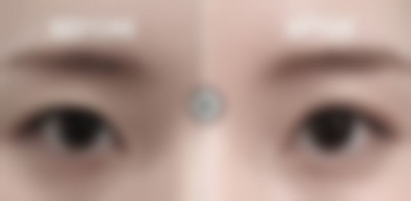 【武汉丽星整形医院参考价格表：】