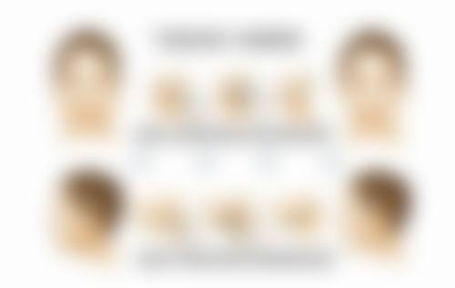 注射瘦脸针有副作用吗？揭秘3大常见误区，了解正确注射方式让你安全变美无负担！ 