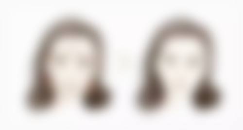 种植的头发长出来为什么是弯曲的