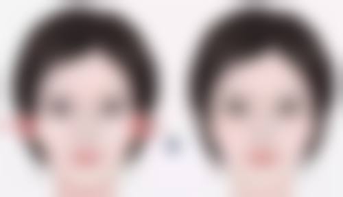 种植的头发多久可以稳固扎根