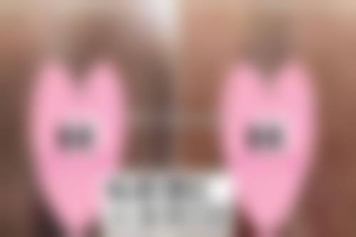 【汉中星妍整形医院患者口碑评价：】