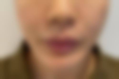 【衡阳凡美医疗美容门诊部是正规的吗?】