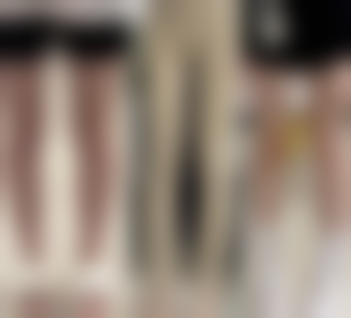 一笑嘴巴就歪多久可以修复