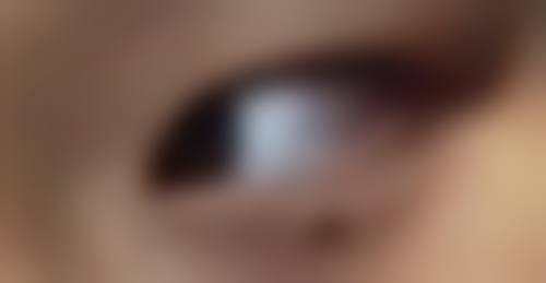 门诊部为了确保能够为患者提供优质的服务,配备了精良的诊疗设备。虽然没有详细列举设备的名称,但从院长多次赴韩国学习精良整形技术可以推测,门诊部的设备应该紧跟行业前列。精良的设备能够更精细地进行手术操作,提高手术的安心性和成效,减少患者的痛苦和修复时间。例如在膨体隆鼻手术中,精良的设备可以更严谨地塑造鼻子的形状,使其更加自然美观;在假体隆胸手术中,也能更好地确保手术的顺利进行和术后的成效。