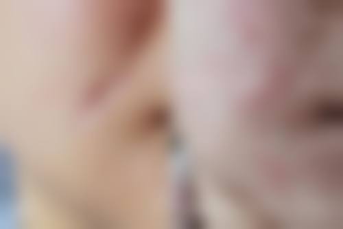 【厦门/泉州素色医疗美容诊疗设备:】