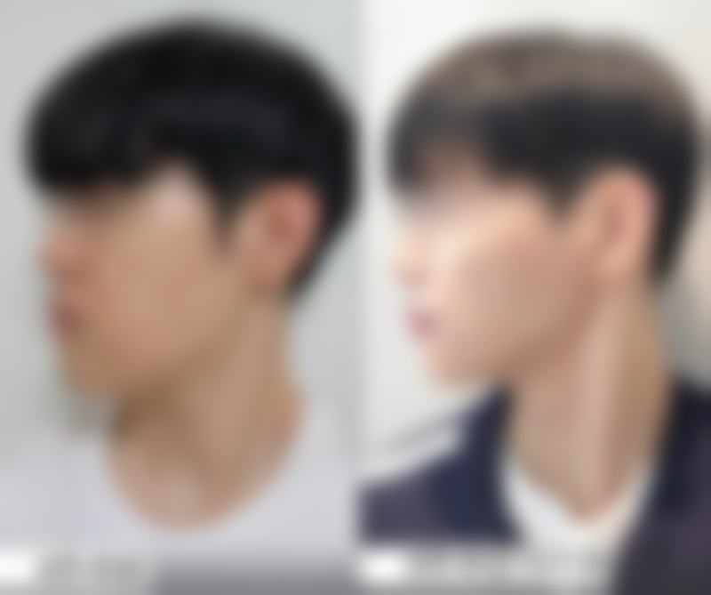 【韩国娜木女性私密整形医院特色项目:】