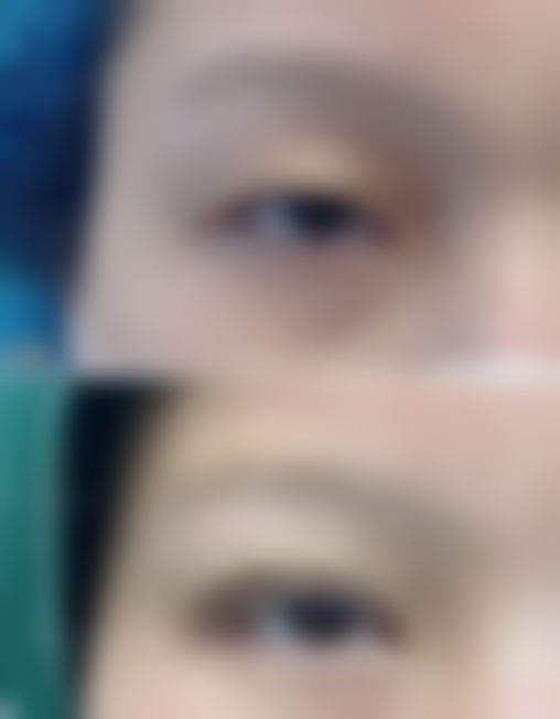 【东莞美熙伊美医疗美容医院是正规的吗?】