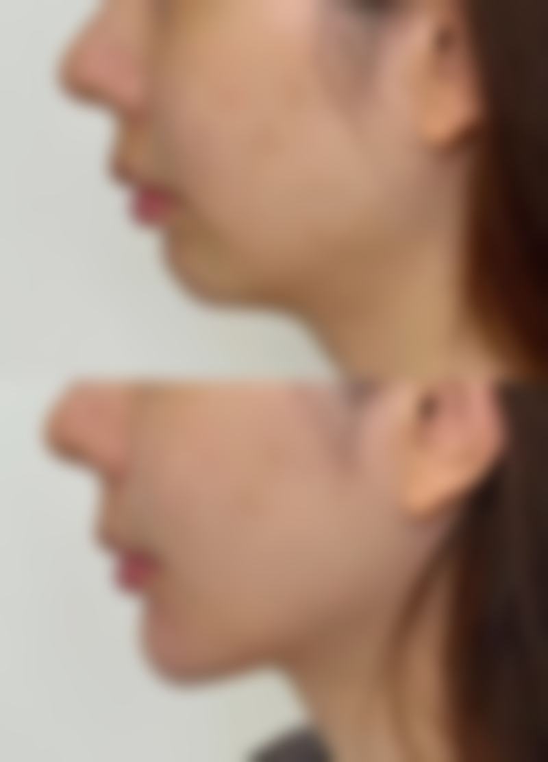 【东莞美熙伊美医疗美容医院参考价格表:】