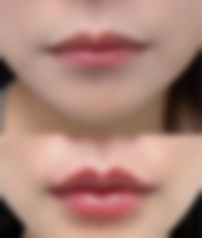 【李准镐医生技术特点】