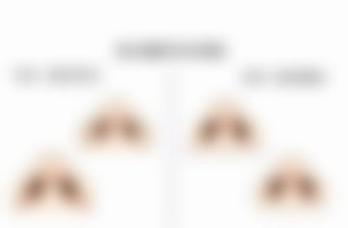 种植毛发到底好不好？权威数据揭示95%满意度！医美新趋势，让你告别脱发烦恼重拾自信容颜！ 