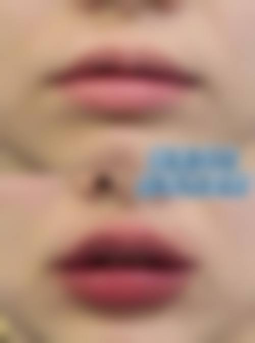 【四川南充华美名媛医疗美容门诊部特色项目:】