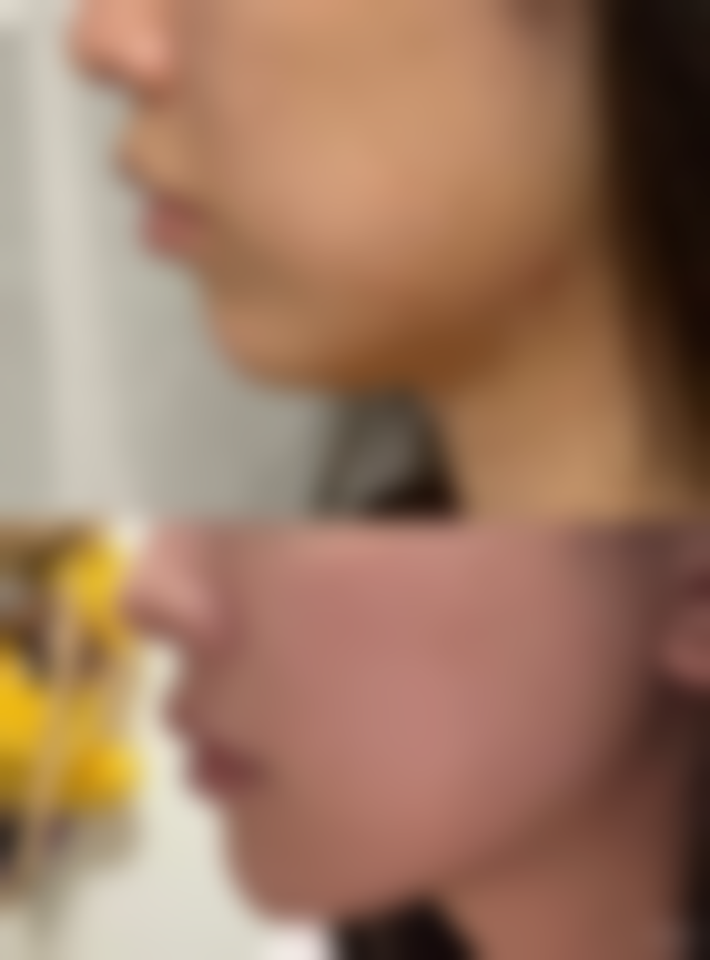 【鞍山任凌莘美容诊所诊疗设备：】