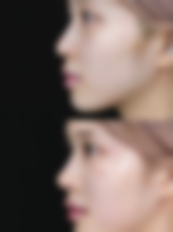 【鞍山任凌莘美容诊所患者口碑评价：】