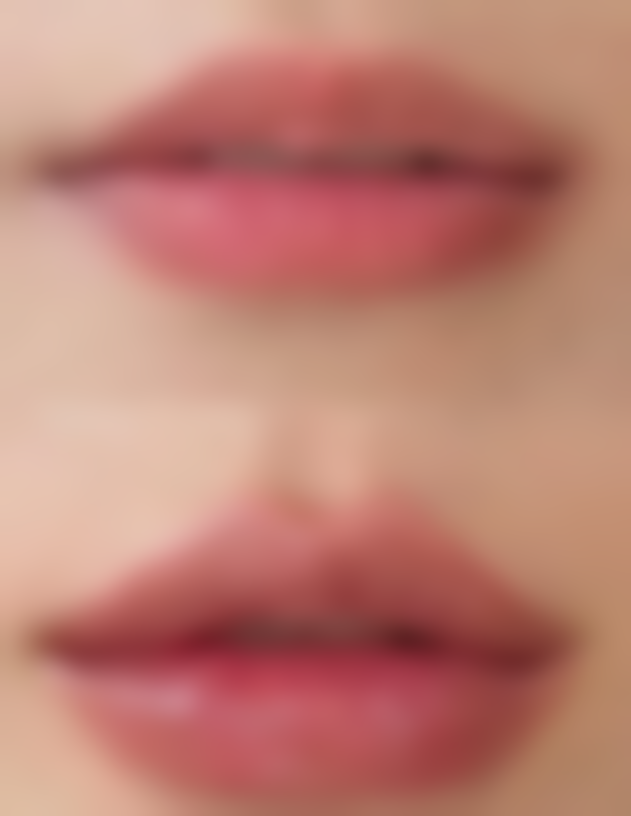 注射瘦脸针的后遗症