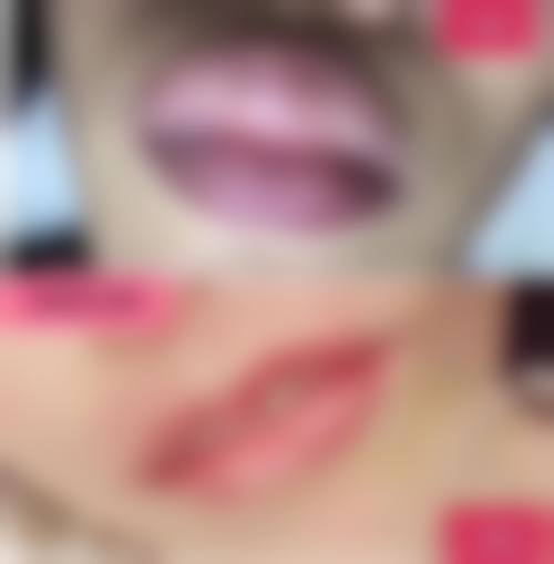 头发种植成活率有多高