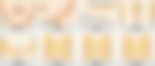 瘦脸针打几次可以恒久定型