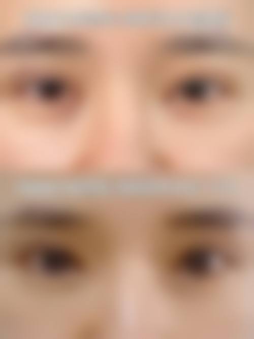 【合肥市第一人民医院滨湖院区(烧伤整形科)是正规的吗?】