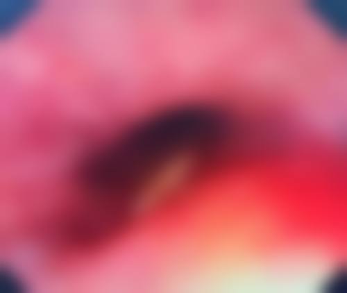 【长沙市伊百丽医疗整形是正规的吗?】