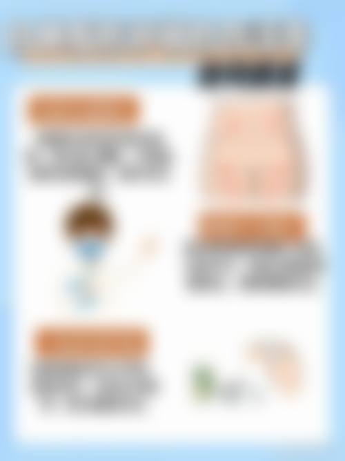 【张鹏云医生技术特点：】