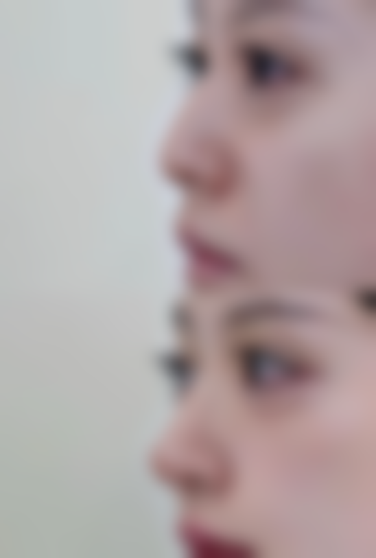 【崔裕炅医生技术特点】