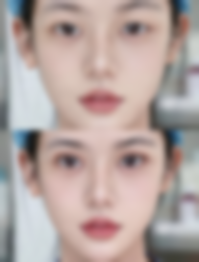 头发种植是恒久的吗