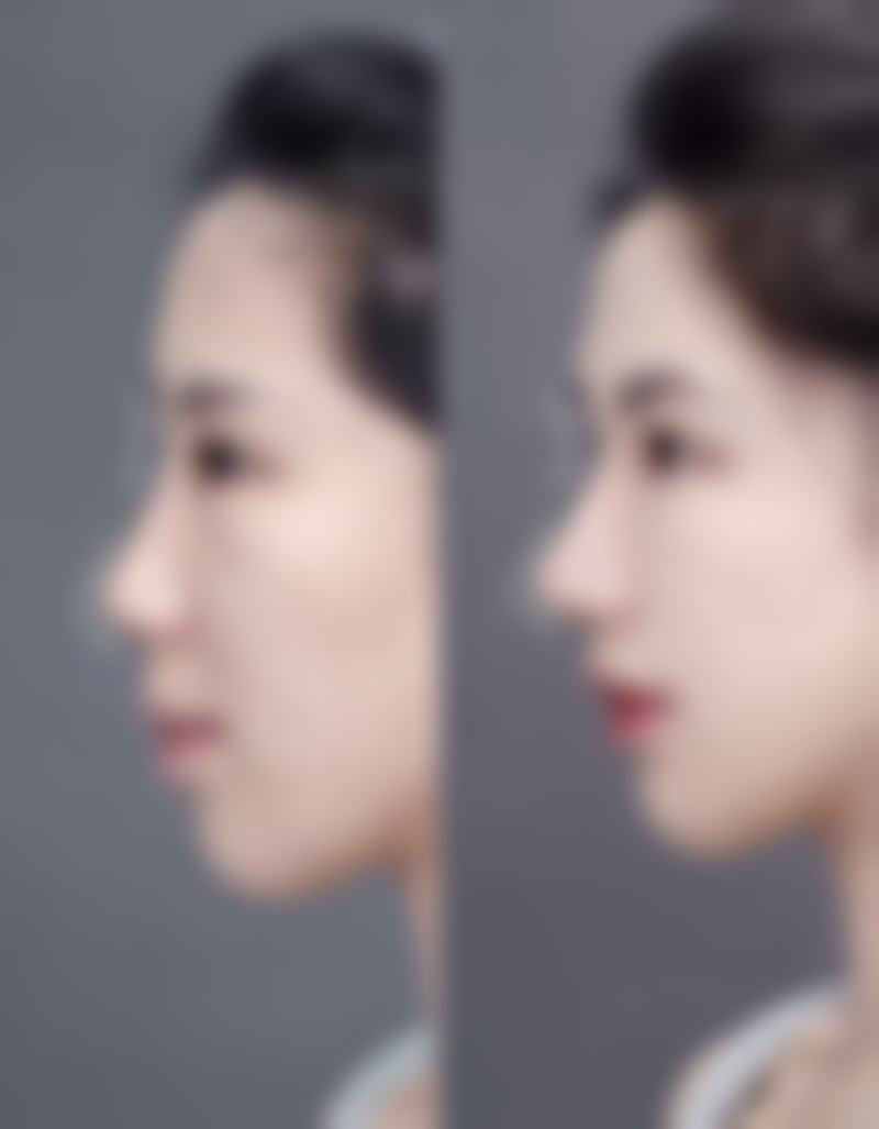 医院的医生队伍强大，所有医生均有10年以上工作经验，对待每台手术都认真负责，致力于打造成功手术实例。医院还特聘专精医生定期进行学术交流，与本院医生共同手术，互相吸取经验，以更好地处理复杂整形手术实例。虽然没有具体医生名字，但能看出医生团队的专精度和丰富经验。