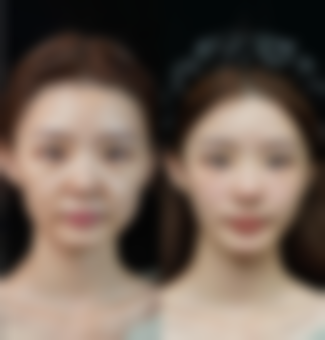 【鲁开贵医生口碑】