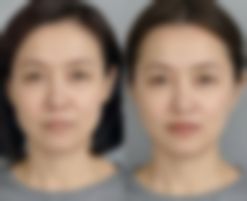 【合肥市第一人民医院滨湖院区(烧伤整形科)特色项目：】