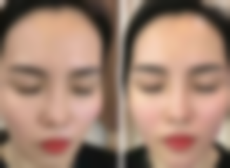 【佛山市顺德区北滘医院整形美容科是正规的吗?】