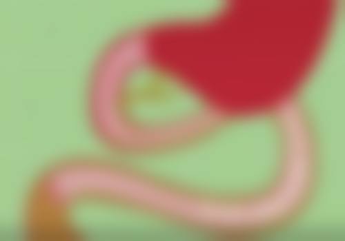 不同下巴整形方法的价格及适用人群