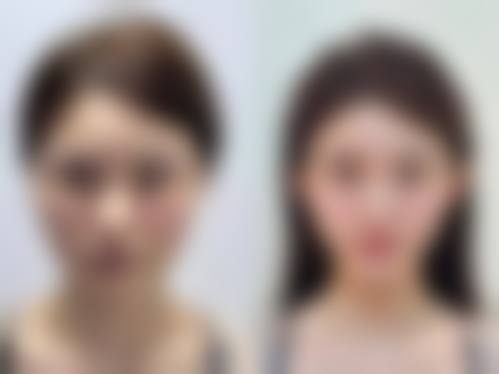 【黄石德尔美客美亚医疗美容诊疗设备：】