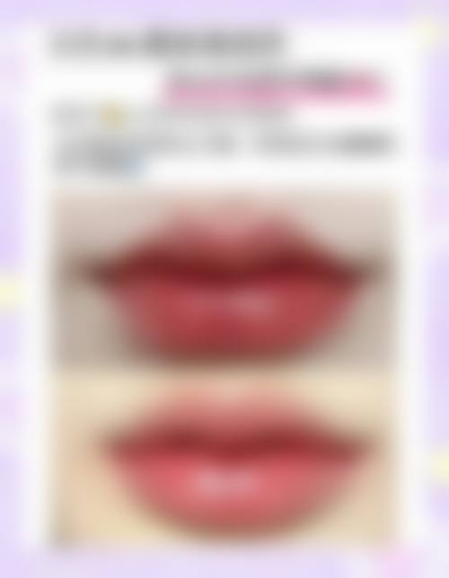 【罗思医生技术特点：】