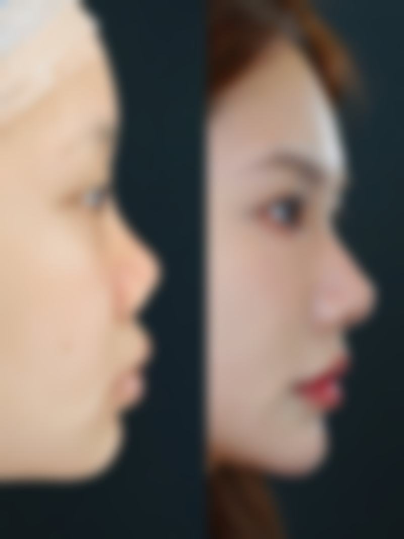 【姬广翰医生技术特点：】