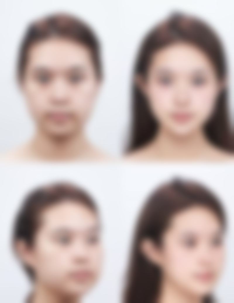 【黄石德尔美客美亚医疗美容参考价格表：】