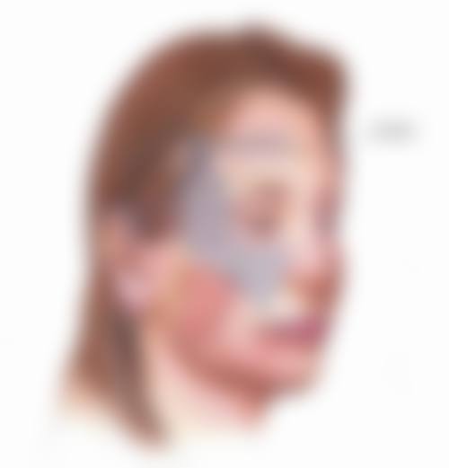 瘦脸针1ml是100单位吗