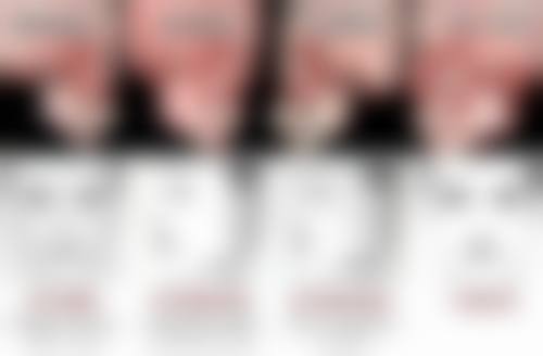 种植头发有危害吗