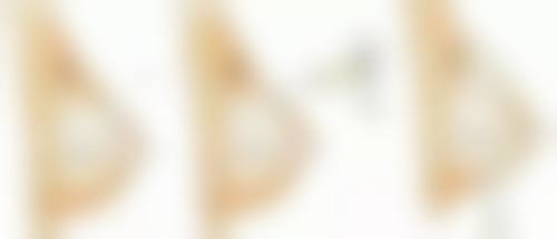 种植头发的危害是什么