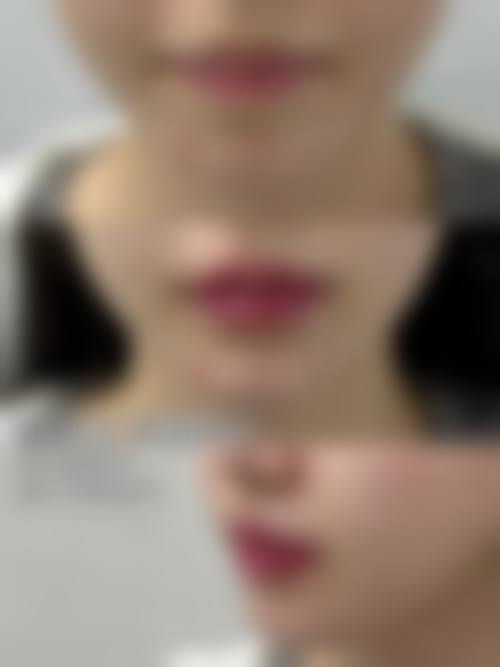 【温州翁捷迈医疗美容诊所特色项目：】