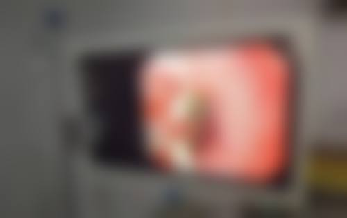 【临夏回族自治州姜美尔医疗美容门诊部诊疗设备：】