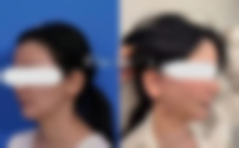 【温州翁捷迈医疗美容诊所参考价格表：】