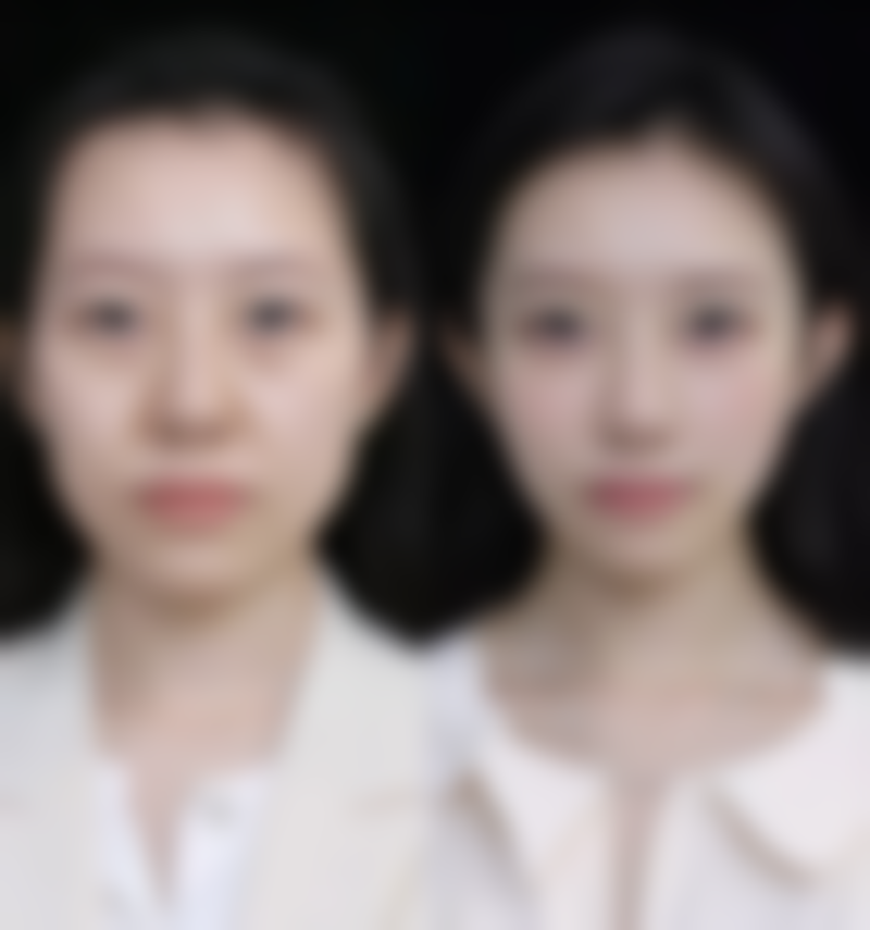 种植头发有危险吗存活率高吗