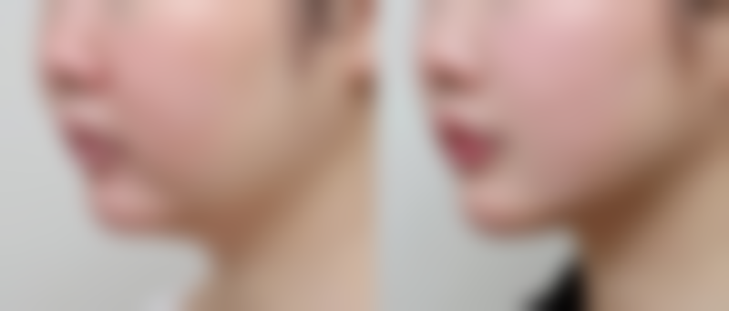 南瓜种植要掐头吗图片