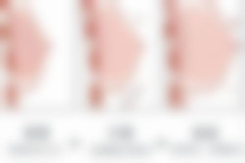 【武汉维纳斯博爱医院医疗美容科参考价格表：】