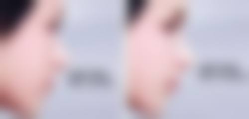 怎样让自己的阴道紧缩？掌握这5种科学方法，有效提升紧致度，重获性福生活！ 