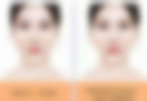 【俞律峰医生擅长项目：】