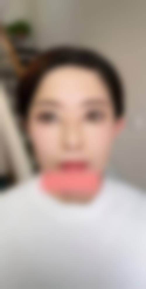 【李万水医生擅长项目】