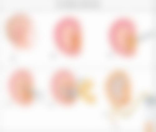 【武汉维纳斯博爱医院医疗美容科特色项目：】